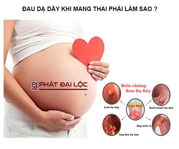 Đau dạ dày khi mang thai phải làm sao ? Nguyên nhân và giải pháp an toàn cho các mẹ bầu