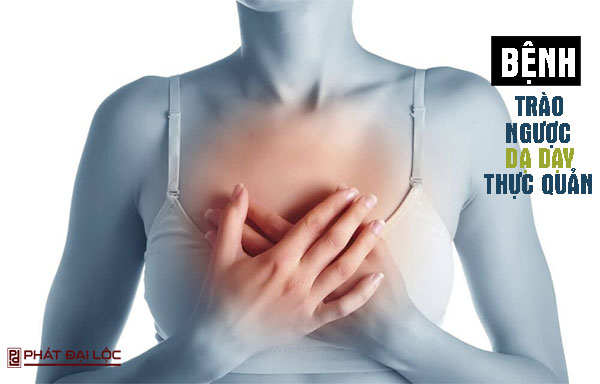trào ngược dạ dày